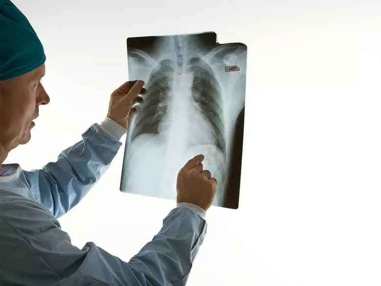 Disnea en la bronquitis y la neumonía 