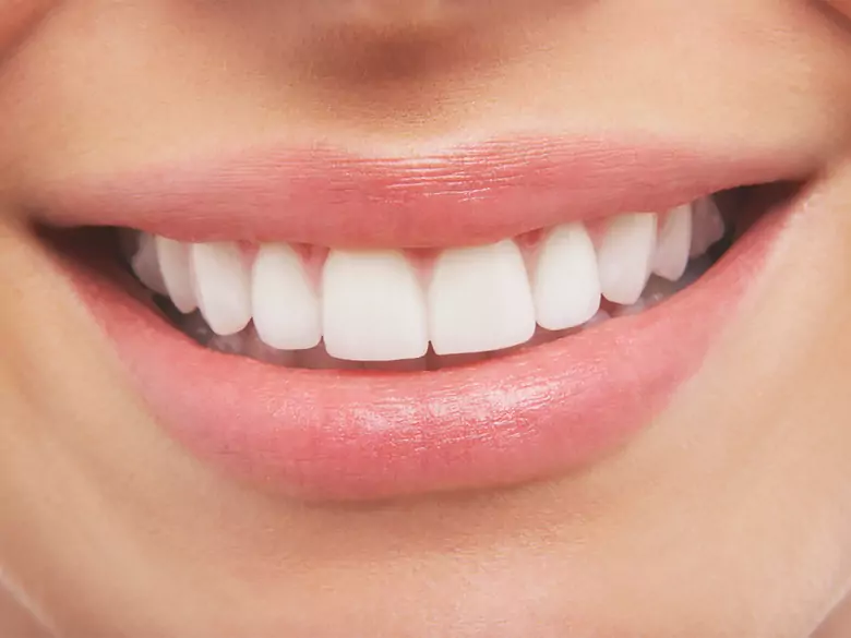 Restauraciones sobre implantes