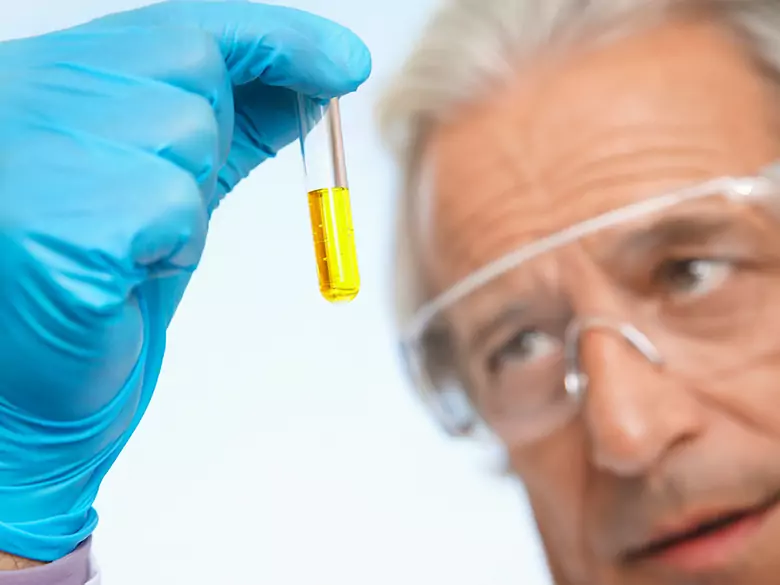 Resultado del análisis de orina - presencia de bacterias