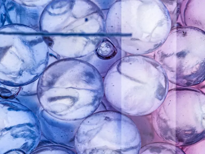 Intoxicación por ácido corrosivo - causas, síntomas, diagnóstico, tratamiento