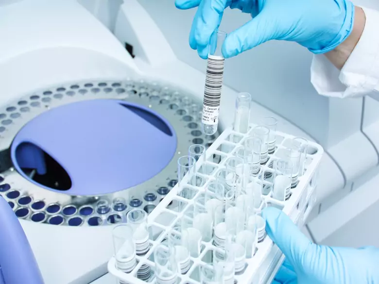 ¿Puede una prueba de saliva detectar el cáncer de páncreas?