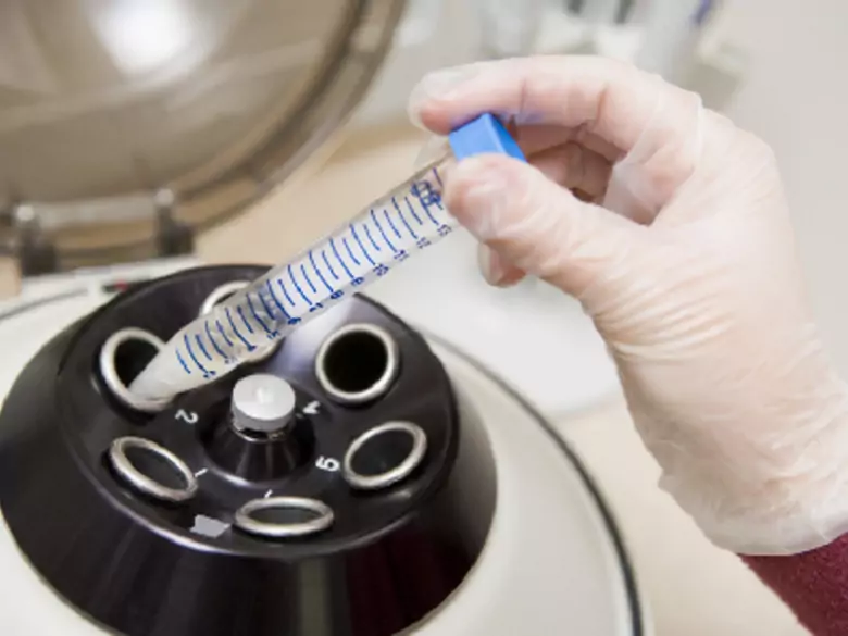 El 4 de octubre es el Día Internacional contra el Cáncer