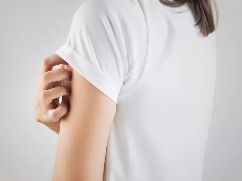 ¿Cómo tratar la seborrea cutánea excesiva?