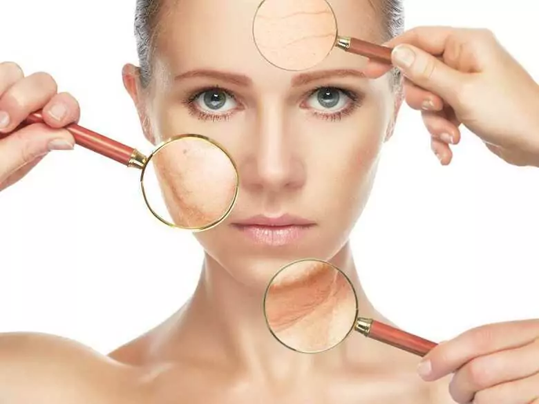 Vasos sanguíneos agrietados (arañas vasculares) en el cuerpo: causas