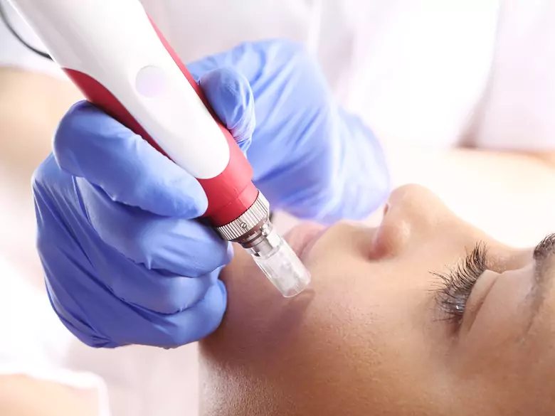 Quiste cutáneo sebáceo (quiste sebáceo) - infórmese sobre las opciones de tratamiento