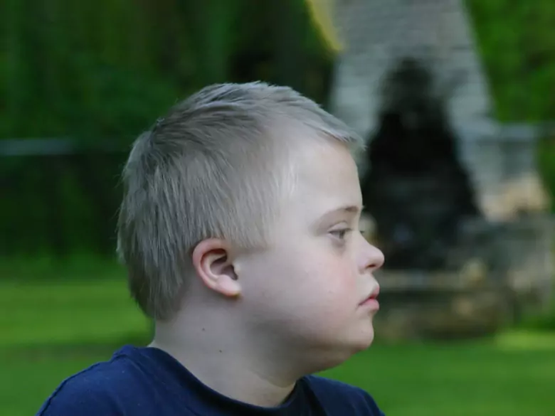 Definición y tipos de retraso mental