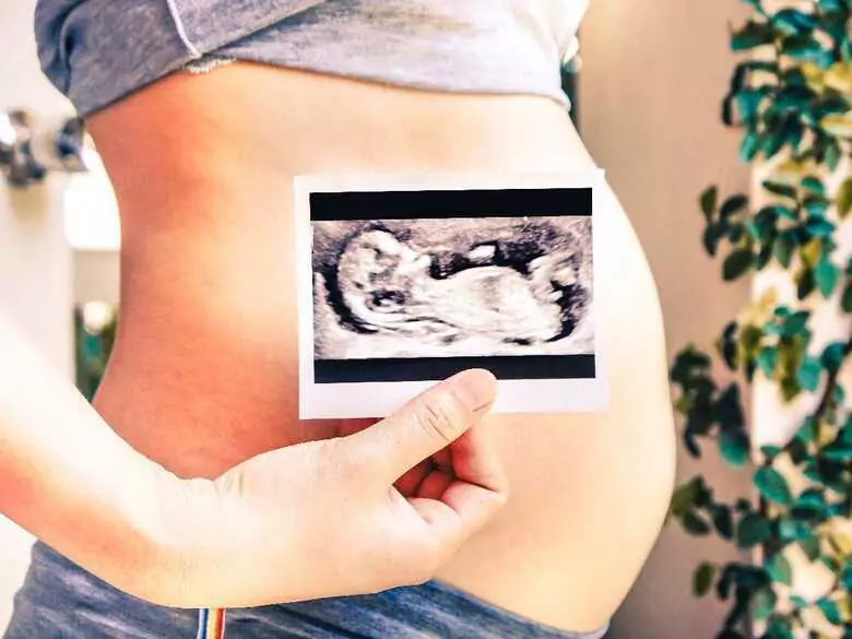 Ecografía en el embarazo