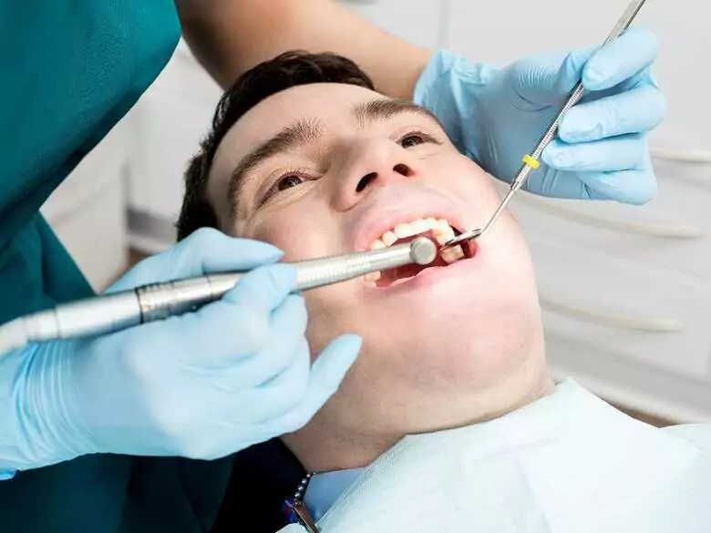 Carillas dentales - pros y contras