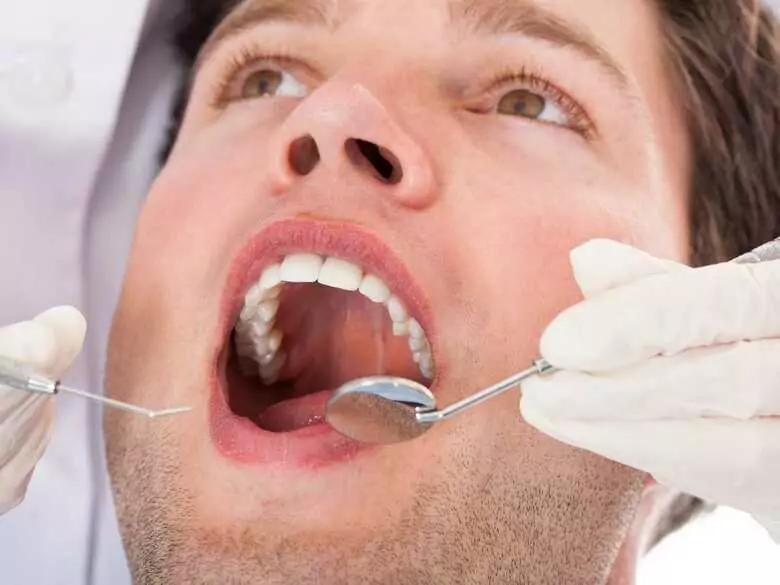 ¿Cómo prevenir la caries?