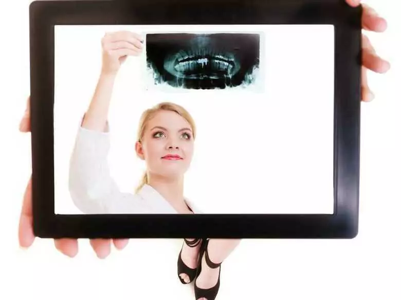 Cuellos dentales expuestos - causas, síntomas, diagnóstico, tratamiento