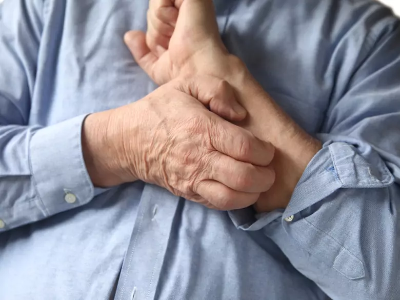 Prurito psicógeno: el vínculo entre dermatología y psiquiatría