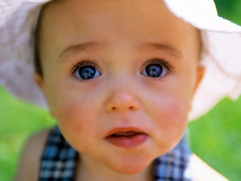 Diarrea sanguinolenta en un niño - causas, síntomas, diagnóstico, tratamiento