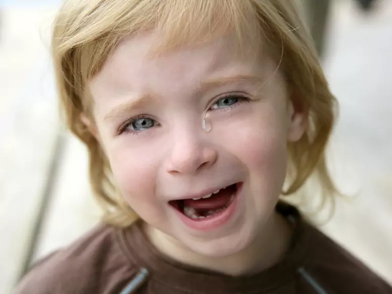 El "patito feo" en el ortodoncista