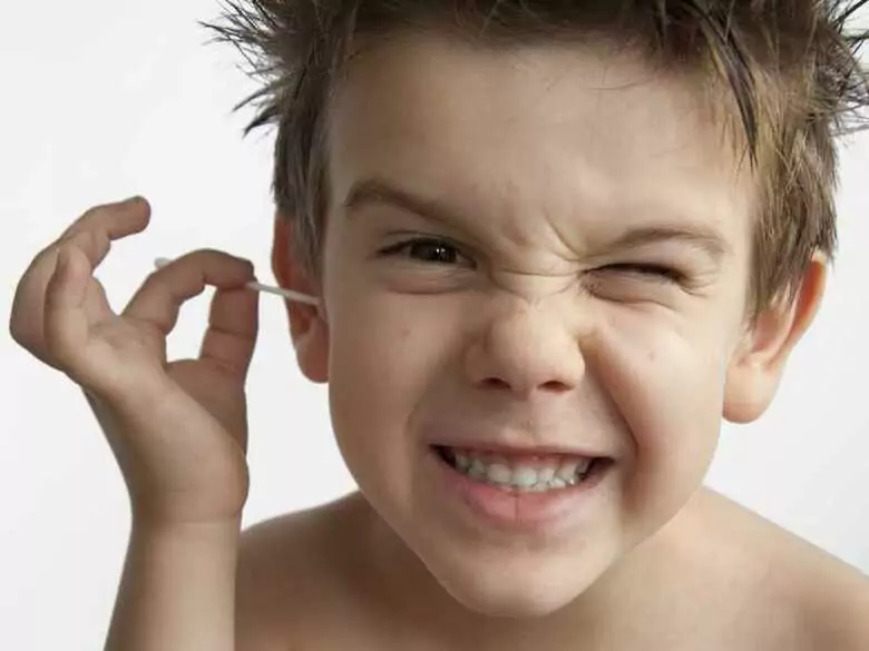 Otitis media exudativa