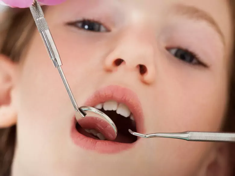 Amígdalas palatinas en niños - causas, síntomas, diagnóstico, tratamiento