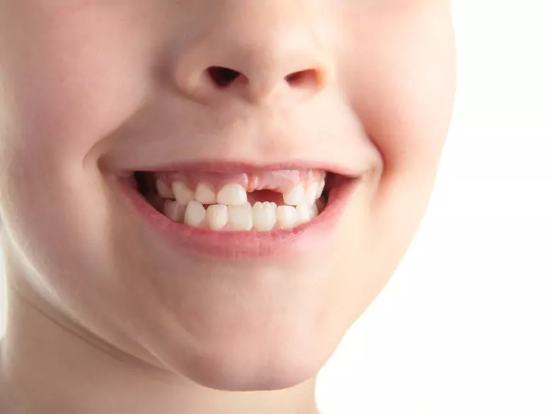 Picar entre horas pone a los niños en riesgo de padecer caries y obesidad