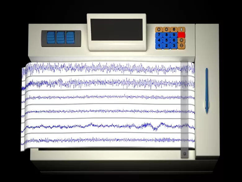 Métodos de diagnóstico en el diagnóstico de las arritmias cardiacas