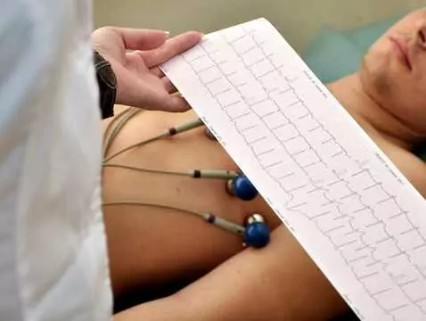 ¿Qué es una prueba de ECG?
