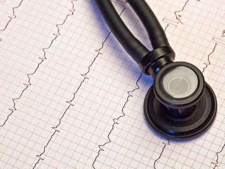 Diagnóstico de la enfermedad arterial coronaria: ¿qué pruebas deben realizarse?