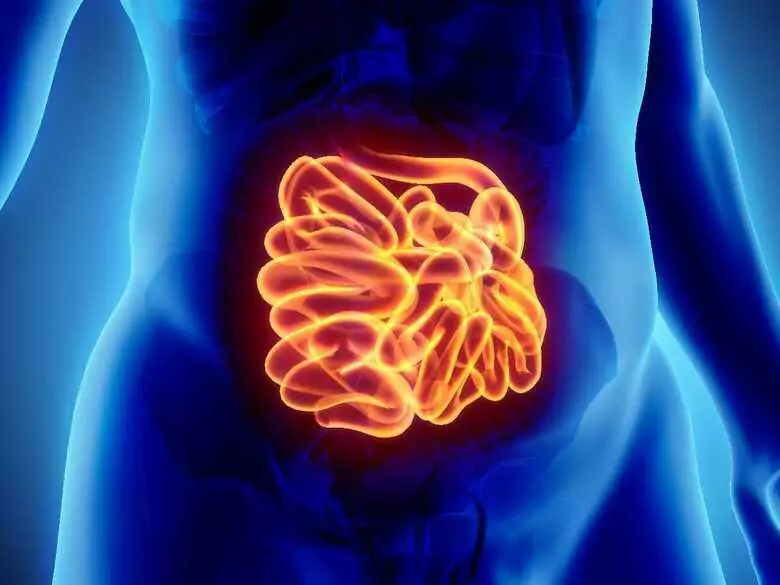 Correlación entre la fructosa en la dieta y la enfermedad inflamatoria intestinal