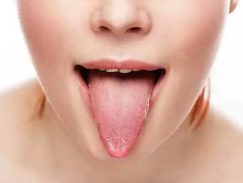 ¿Cuáles pueden ser las causas del dolor de lengua?