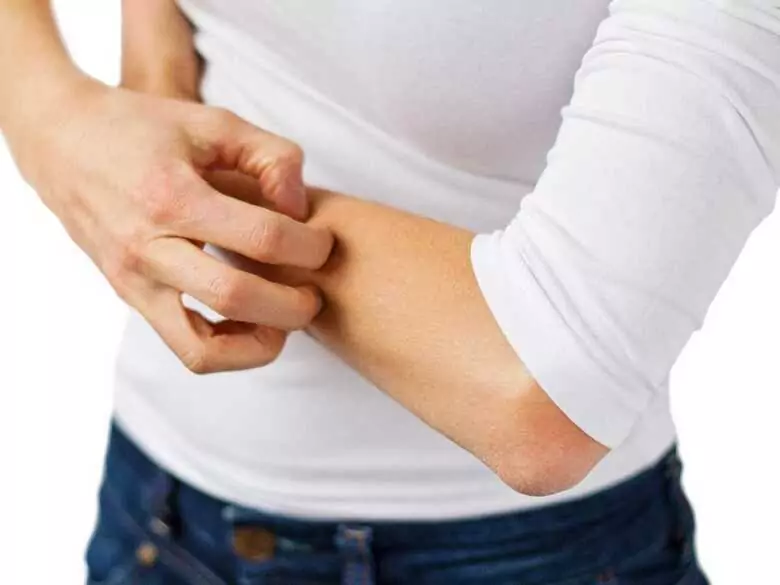 Piel agrietada en las manos después de usar detergente líquido: ¿es ya una alergia?