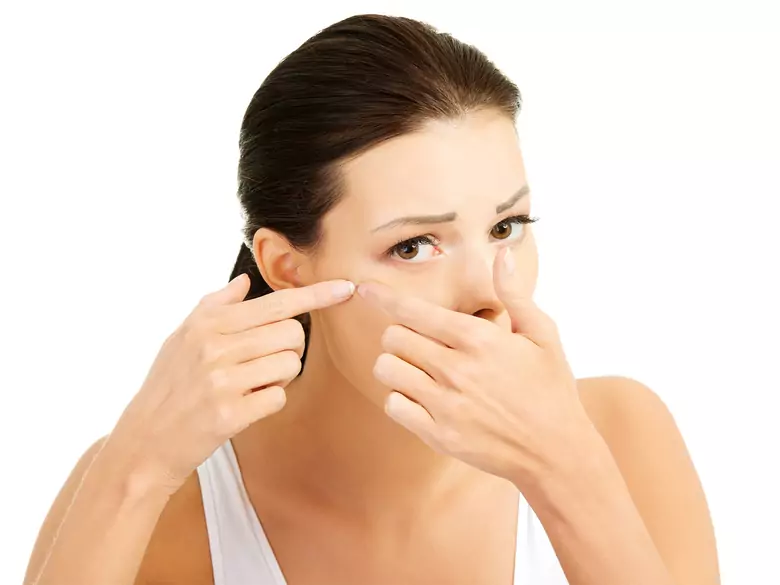 Terapia hormonal en mujeres con acné