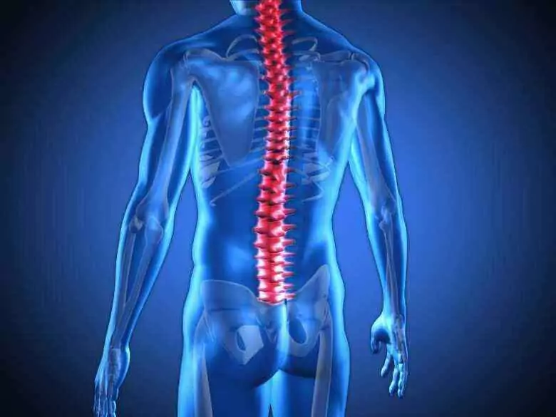 Discopatía de la columna lumbar