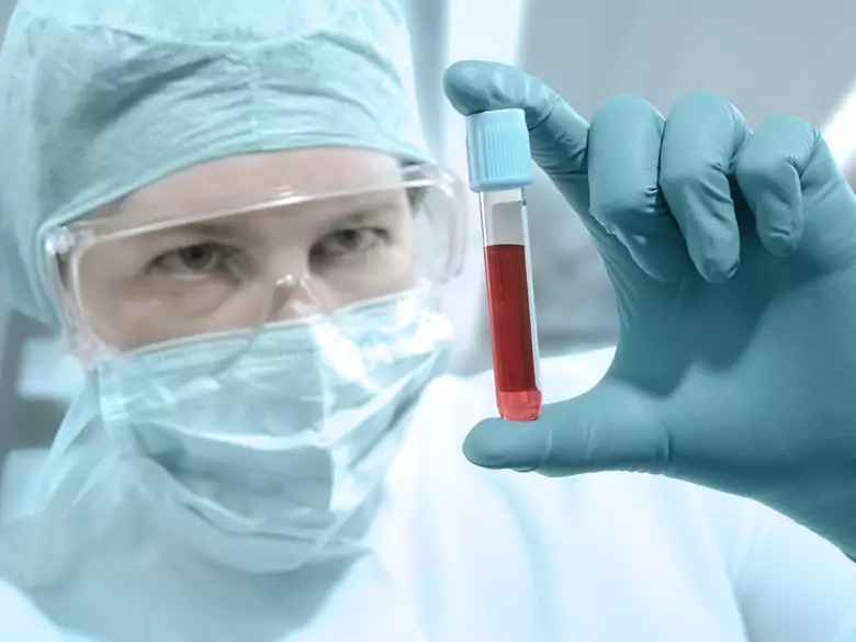 ¿El riesgo de infección por el VIH afecta también a las mujeres embarazadas?