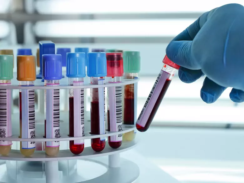 Enfermedades hematopoyéticas