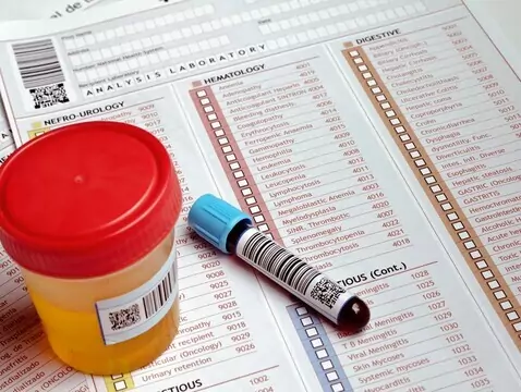 Endocrinología del periodo menopáusico