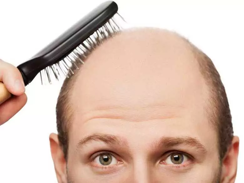 ¿Esteroides? En lugar de esculpir, infertilidad y calvicie