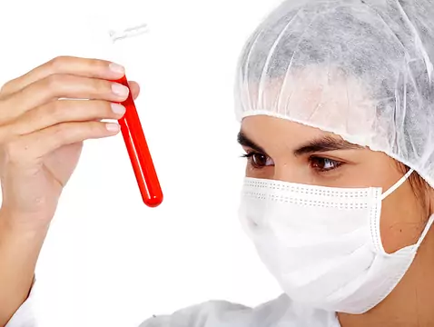 Marcador de cáncer de mama CA 15-3