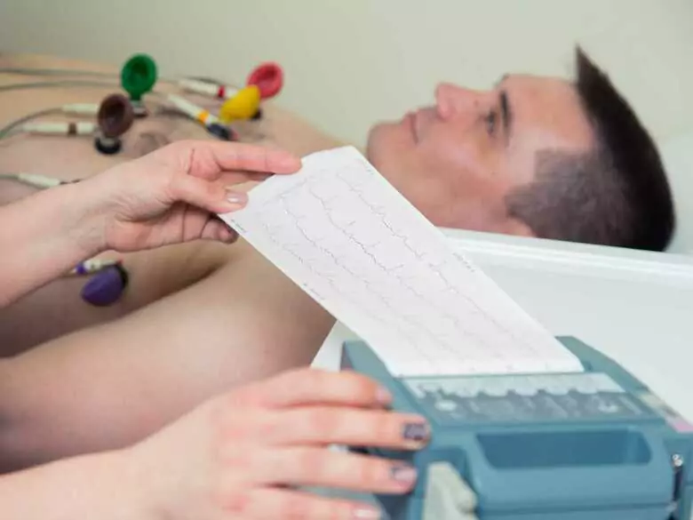 Trastornos del ritmo cardiaco