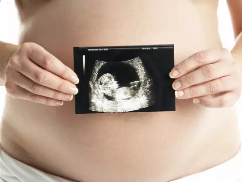 Recomendaciones de la PTG sobre el diagnóstico ecográfico en obstetricia
