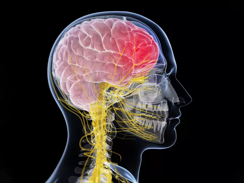 ¿Qué es la enfermedad de Gaucher?