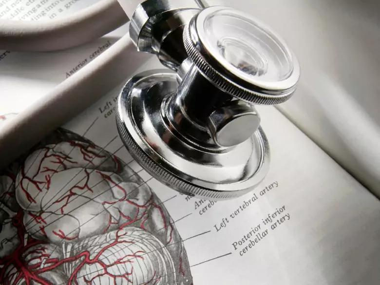 Ataques isquémicos cerebrales transitorios