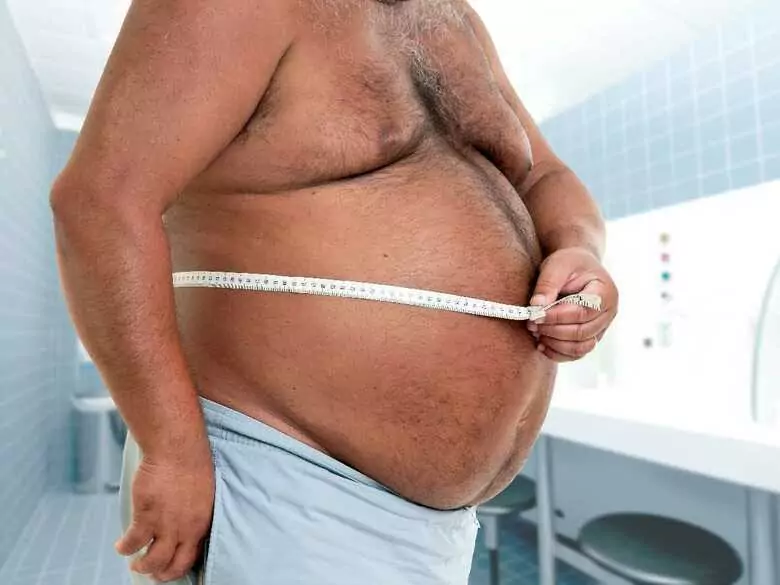 ¿Qué es el sobrepeso y la obesidad?