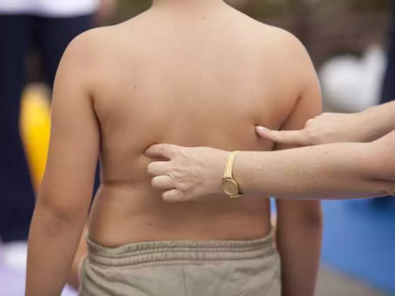 Aterosclerosis e infarto de miocardio en niños: ¿es posible?