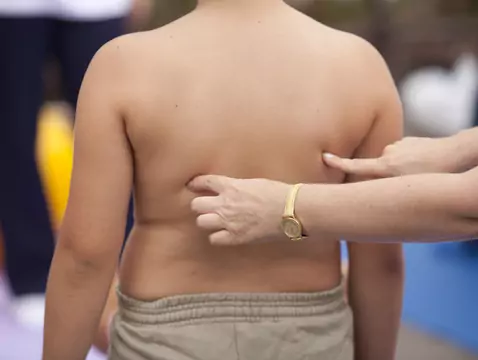 Aterosclerosis e infarto de miocardio en niños: ¿es posible?