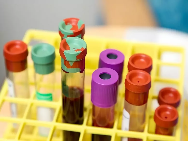 Oncopackage: ¿por qué son tan importantes las pruebas de micronutrientes para la detección del cáncer?