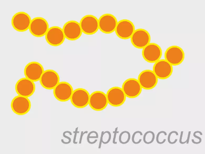 Prueba EAR - título elevado