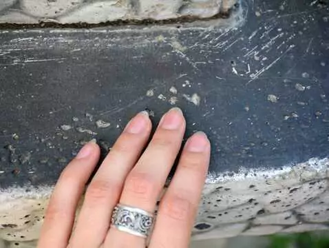 Hongos en las uñas - causas, síntomas, diagnóstico, tratamiento