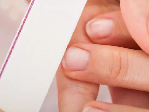 Cambios en la placa ungueal y tiña