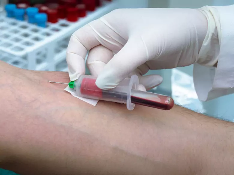 Pruebas de detección de drogas en el cuerpo