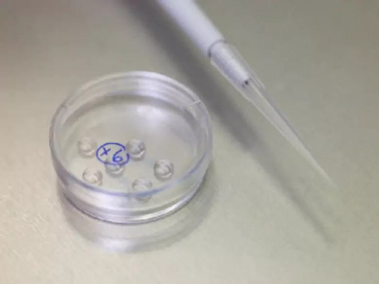 Error en el código del gen BACD1 o BACD2 responsable no sólo del cáncer de mama