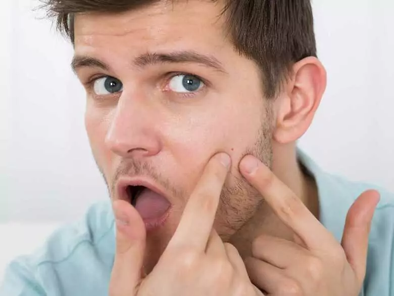 Tres enfermedades cutáneas que pueden ser síntoma de problemas psicológicos