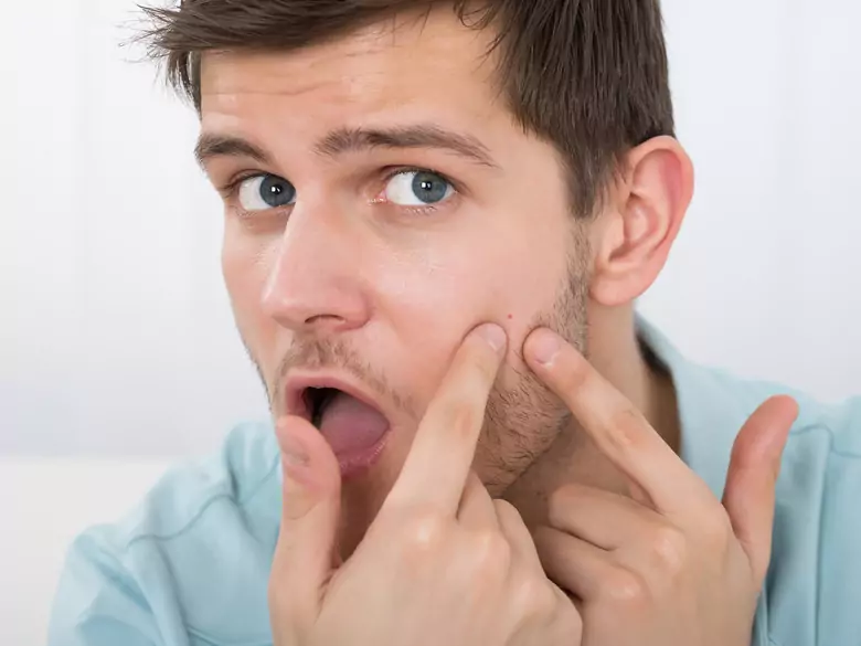 Acné y vitamina D: ¡descubra la conexión!