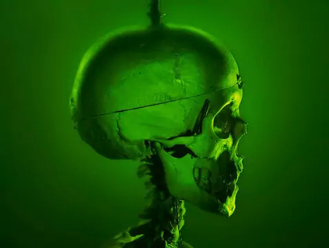 Sífilis del sistema nervioso - causas, síntomas, diagnóstico, tratamiento