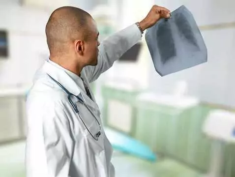 Epidemia de tuberculosis en nuestra frontera oriental